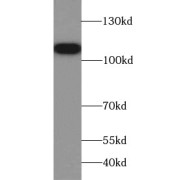 WB analysis of HeLa cells, using MSH2 antibody (1/1000 dilution).