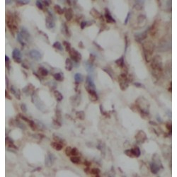 DNA Mismatch Repair Protein Msh2 (MSH2) Antibody