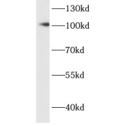 WB analysis of HeLa cells, using MSH2 antibody (1/500 dilution).