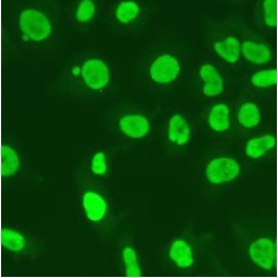 G/T Mismatch-Binding Protein (MSH6) Antibody