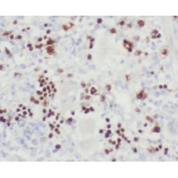 G/T Mismatch-Binding Protein (MSH6) Antibody