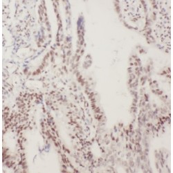 G/T Mismatch-Binding Protein (MSH6) Antibody