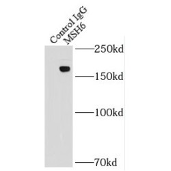 G/T Mismatch-Binding Protein (MSH6) Antibody