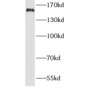 WB analysis of HEK-293 cells, using MSH6 antibody (1/1000 dilution).