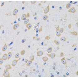 Mitochondrial Peptide Methionine Sulfoxide Reductase (MSRA) Antibody