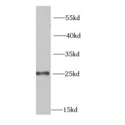 WB analysis of human kidney tissue, using MSRA antibody (1/1000 dilution).