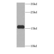 WB analysis of mouse heart tissue, using MSRB2 antibody (1/1000 dilution).