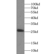 WB analysis of mouse testis tissue, using MSRB3 antibody (1/600 dilution).