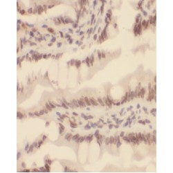 Metastasis Associated Protein 2 (MTA2) Antibody