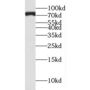 WB analysis of Jurkat cells, using MTA2 antibody (1/800 dilution).