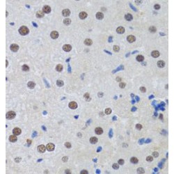 Metastasis-Associated Protein MTA3 (MTA3) Antibody