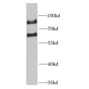 WB analysis of HepG2 cells, using MTA3 antibody (1/1000 dilution).