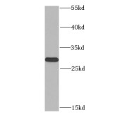 WB analysis of MCF7 cells, using MTAP antibody (1/1000 dilution).