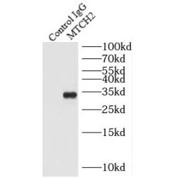 Mitochondrial Carrier 2 (MTCH2) Antibody