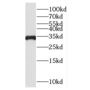 WB analysis of HeLa cells, using MTCH2 antibody (1/1000 dilution).