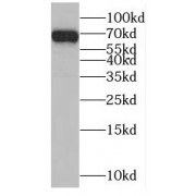 WB analysis of mouse liver tissue, using MTF1 antibody (1/1000 dilution).