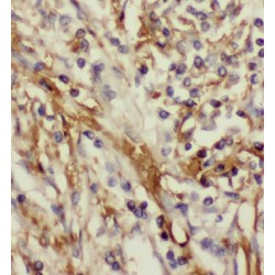 7,8-Dihydro-8-Oxoguanine Triphosphatase (MTH1) Antibody