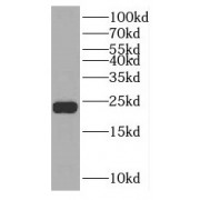 WB analysis of HepG2 cells, using NUDT1 antibody (1/300 dilution).