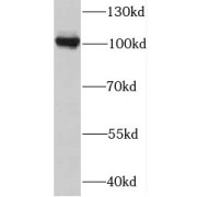 WB analysis of mouse kidney tissue, using MTHFD1 antibody (1/600 dilution).