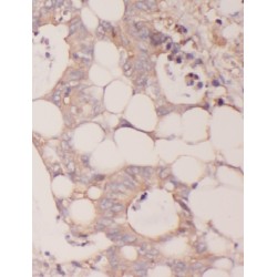 Bifunctional Methylenetetrahydrofolate Dehydrogenase/cyclohydrolase, Mitochondrial (MTHFD2) Antibody