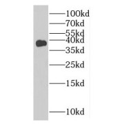 WB analysis of Jurkat cells, using MTHFD2 antibody (1/300 dilution).