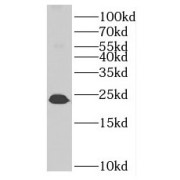 WB analysis of human liver tissue, using MTHFS antibody (1/500 dilution).