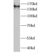 WB analysis of mouse colon tissue, using MTMR4 antibody (1/500 dilution).