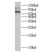 WB analysis of human heart tissue, using MTMR6 antibody (1/500 dilution).