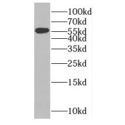 WB analysis of HeLa cells, using MTMR8 antibody (1/300 dilution).