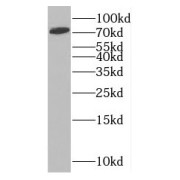 WB analysis of human liver tissue, using MTO1 antibody (1/500 dilution).