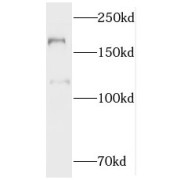 WB analysis of Jurkat cells, using MTUS1 antibody (1/500 dilution).