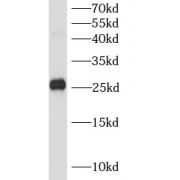 WB analysis of Transfected HEK-293 cells, using CA15-3, MUC1 antibody (1/1000 dilution).