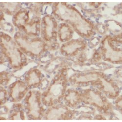 Mitochondrial Ubiquitin Ligase Activator of NFKB 1 (MUL1) Antibody