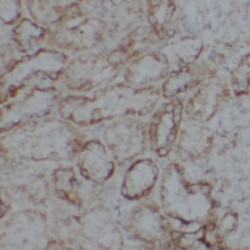 Mucin And Cadherin-Like Protein (MUPCDH) Antibody