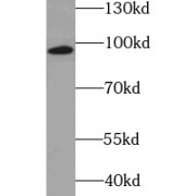 WB analysis of SW480 cells, using MUSK antibody (1/1000 dilution).