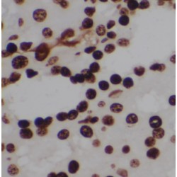 MutY Homolog (MUTYH) Antibody