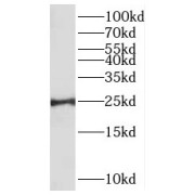 WB analysis of mouse skeletal muscle tissue, using MXD1 antibody (1/800 dilution).