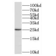 WB analysis of mouse skeletal muscle tissue, using MXD1 antibody (1/800 dilution).