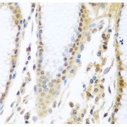 Myb-Binding Protein 1A (MYBBP1A) Antibody