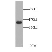 WB analysis of HeLa cells, using MYBBP1A antibody (1/1000 dilution).