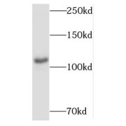 WB analysis of human placenta tissue, using MYCBPAP antibody (1/300 dilution).