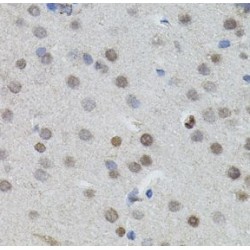 N-Myc Proto-Oncogene Protein (MYCN) Antibody