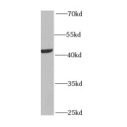 WB analysis of mouse brain tissue, using MYCN antibody (1/1000 dilution).