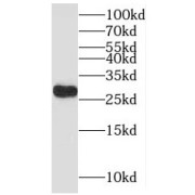 WB analysis of mouse spleen tissue, using MYCT1 antibody (1/1000 dilution).