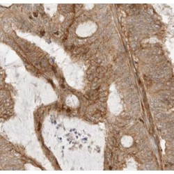 Myeloma Overexpressed (MYEOV) Antibody