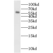 WB analysis of SGC-7901 cells, using MYEOV antibody (1/400 dilution).