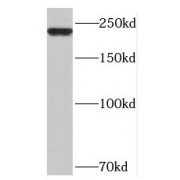 WB analysis of Transfected HEK-293 cells, using MYH1 antibody (1/1000 dilution).