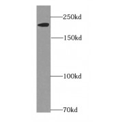 WB analysis of rat heart tissue, using MYH6 antibody (1/5000 dilution).