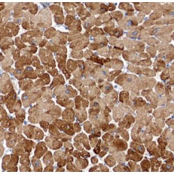 Myosin Light Chain 7, Regulatory (MYL7) Antibody