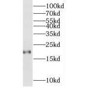 WB analysis of mouse heart tissue, using MYL7 antibody (1/800 dilution).